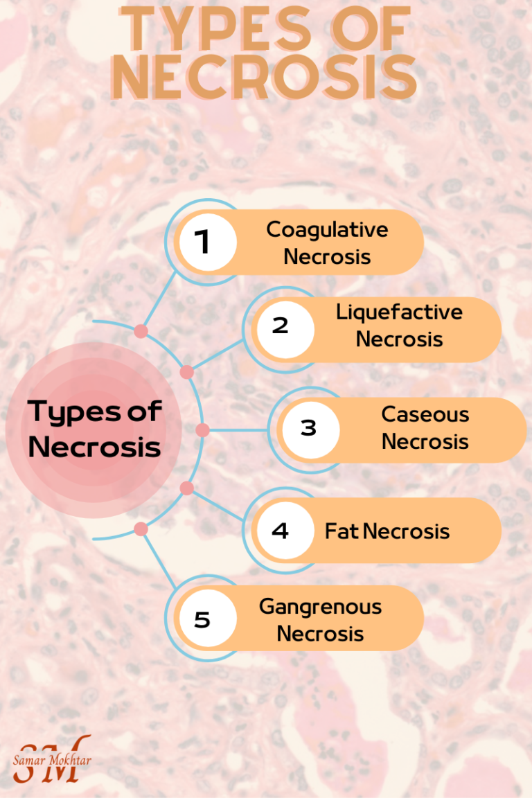 type of necrosis