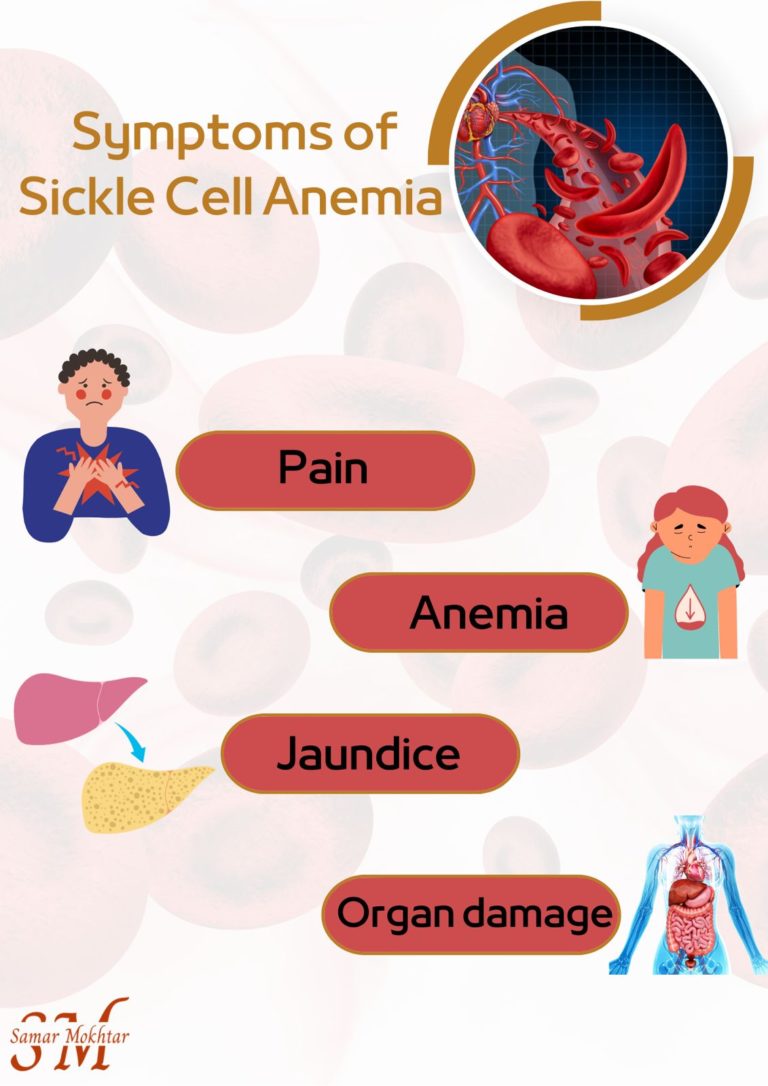 sickle cell disease