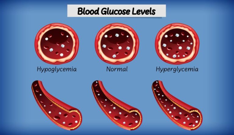 ارتفاع نسبة السكر في الدم
